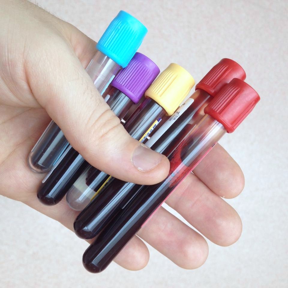 A hand holding several blood collection tubes